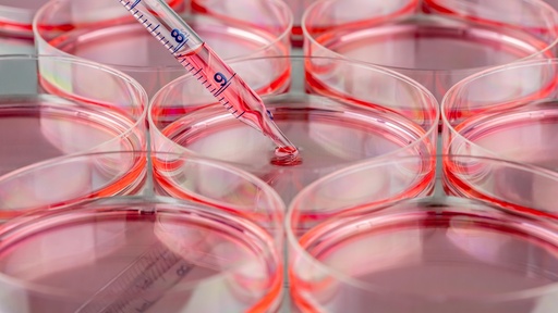 [SA25-b27supplement-78] Tissue culture test plate, 96 wells, U-version 
